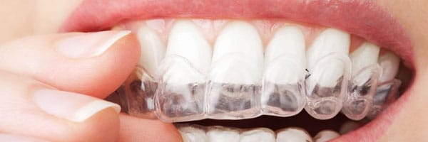 ClearCorrect Orthodontics PPC